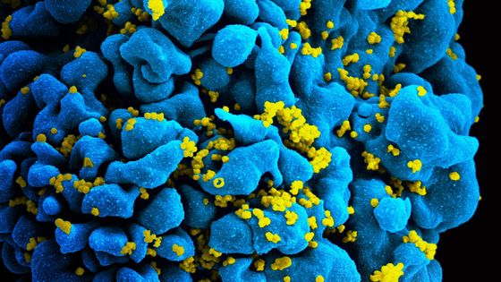 Cellule infectée par le VIH - NIAID