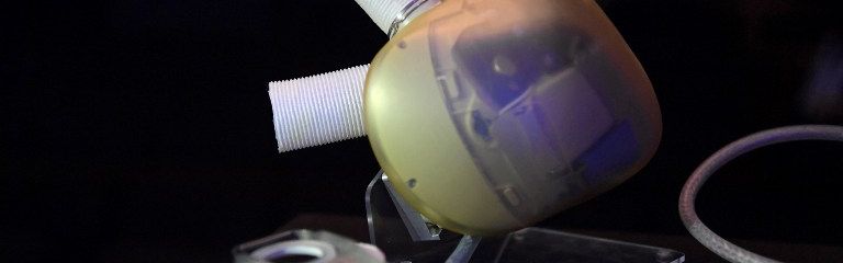 Coeur artificiel de la société Carmat, février 2017