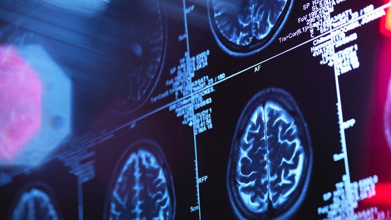 Scanner du cerveau ©Getty