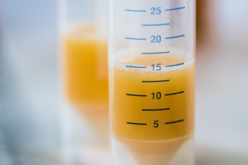 Tube à essais contenant de l'œuf au laboratoire chimique et vétérinaire de l'Office d'investigation de Krefeld, Allemagne, 7 août 2017.