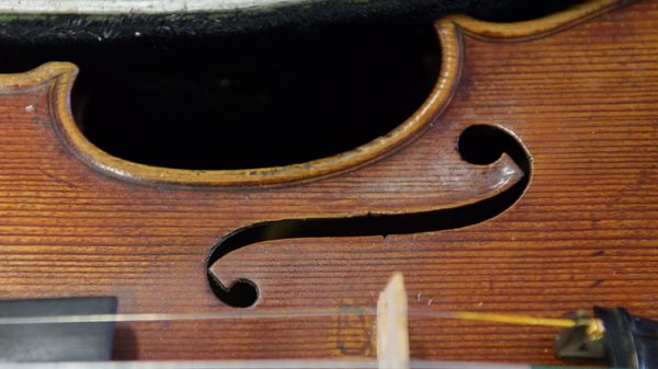 Près de trente ans après un accident, une violoniste handicapée rejoue par la pensée