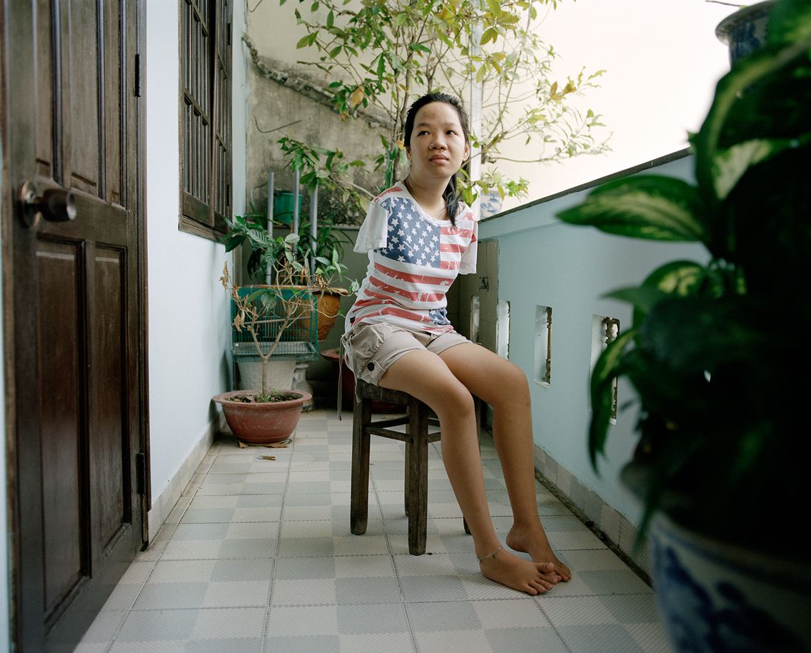 Thuy Linh 21 Ans Troisieme Generation Des Victimes De L Agent Orange