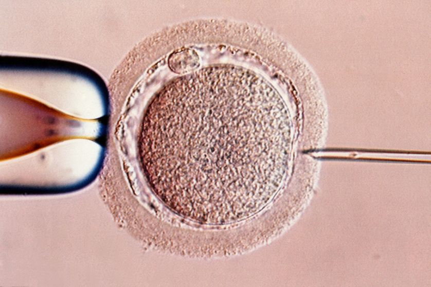 Injection intracytoplasmique de spermatozoïdes ICSI