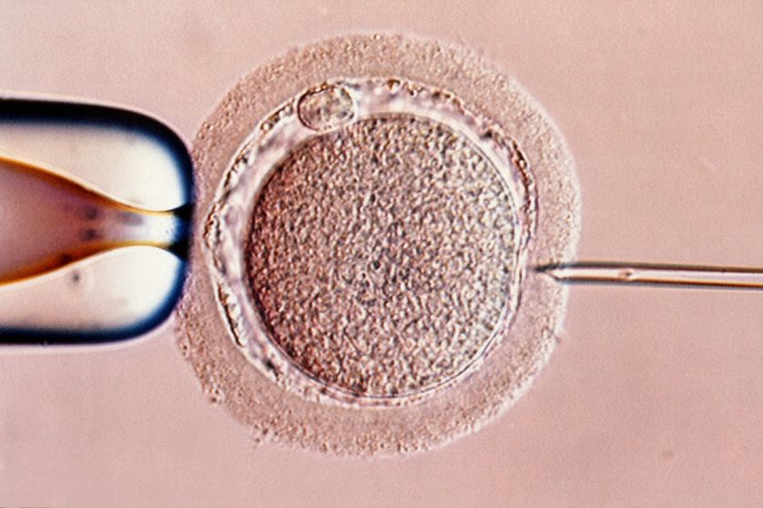 Injection intracytoplasmique de spermatozoïdes ICSI