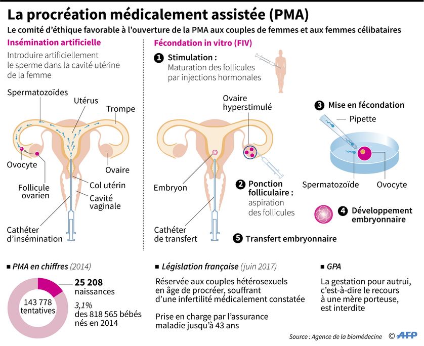 La procréation médicalement assistée