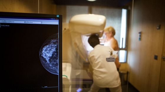 Deux nouvelles publications scientifiques alimentent la controverse sur la mammographie de dépistage du cancer du sein. ©Getty - BSIP