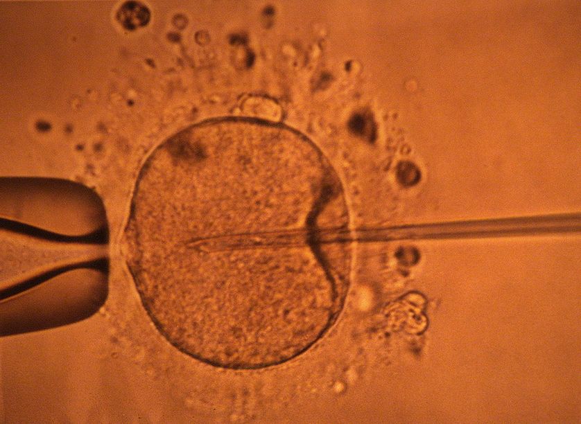 Micro-injection par pipette d'un spermatozoïde dans un ovocyte. Novembre 2000. Rennes