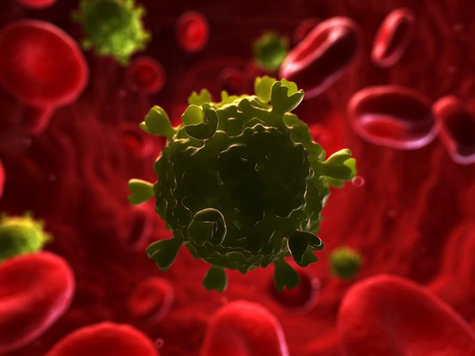 Infection VIH (reconstitution informatique)