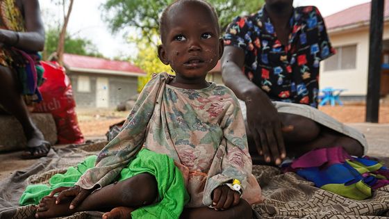 Les enfants victimes de la guerre civile au Soudan du Sud ©Radio France - Benjamin Chauvin