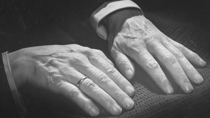 Les mains de Sergueï Rachmaninov. Elles étaient de très grande taille, ce qui lui permettait de jouer des accords complexes.