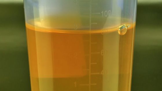 Le boom de l'urine artificielle ©Getty - Douglas Sacha
