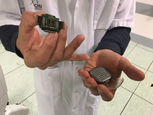 L'implant intégré dans le crane du tétraplégique permet de communiquer les intentions de mouvements à l'exosquelette.