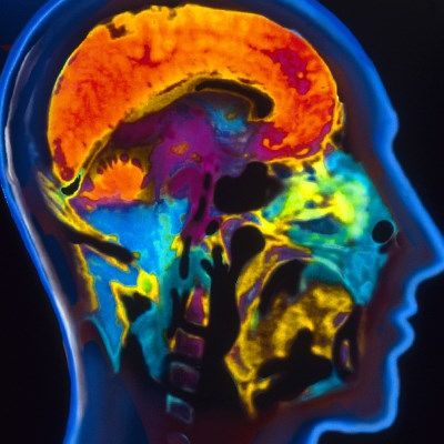 L'imagerie par résonnance magnétique, qui ne produit pas de radiations est précieuse pour les examens du cerveau notamment pour la fosse postérieure et la substance blanche. Ici cerveau normal.