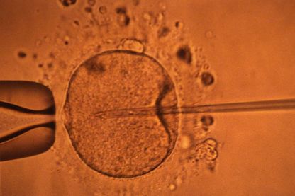 Micro-injection par pipette d'un spermatozoide dans un ovocyte Micro-injection par pipette d'un spermatozoide dans un ovocyte