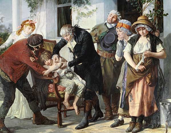Edward Jenner (1749-1823) pratiquant la première vaccination contre la variole en 1796