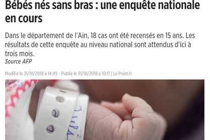 Le site Internet du magazine Le Point illustre l'affaire des bébés nés sans bras avec une main de nourrisson en gros plan. Le site Internet du magazine Le Point illustre l'affaire des bébés nés sans bras avec une main de nourrisson en gros plan.