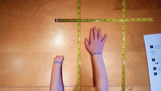 Examen, en 2015, d'une agénésie en vue d'une prothèse en 3D ©AFP - Amélie Benoist / BSIP