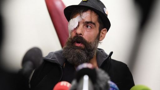 Lors d'une conférence de presse organisée à l'hôpital Cochin, Jérôme Rodrigues, l'une des figures du mouvement des "gilets jaunes", réaffirme avoir subi un tir de lanceur de balles de défense
