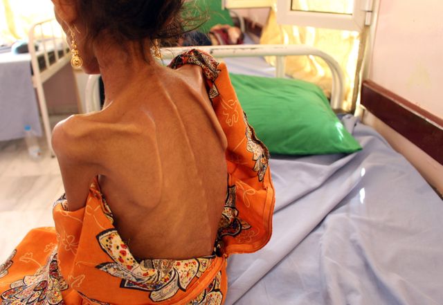Les deux tiers de toutes les régions du pays sont en situation de pré famine