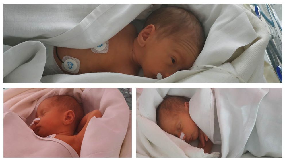 Tours Naissance Exceptionnelle De Triples A L Hopital Bretonneau