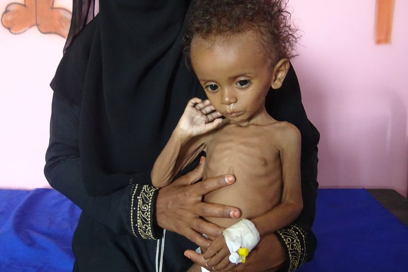 Selon l’ONU, 80 % de la population au Yémen a besoin d’une aide alimentaire d’urgence.