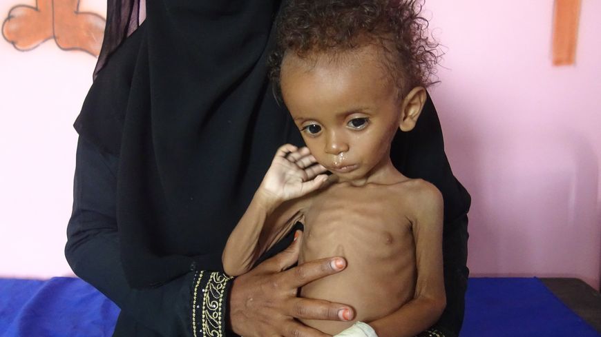 Selon l’ONU, 80 % de la population au Yémen a besoin d’une aide alimentaire d’urgence.
