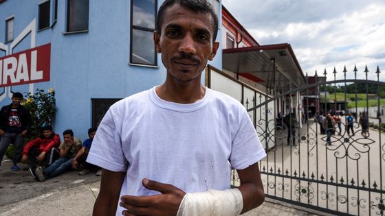 Nadeen Ijazz, réfugié pakistanais blessé dans l'incendie du centre d'accueil de la ville de Velika Kladusa ©AFP - str