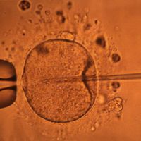 Ecran de contrôle représentant la micro-injection par pipette d'un spermatozoide dans un ovocyte
