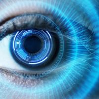 Comment rendre la vue par des implants ?