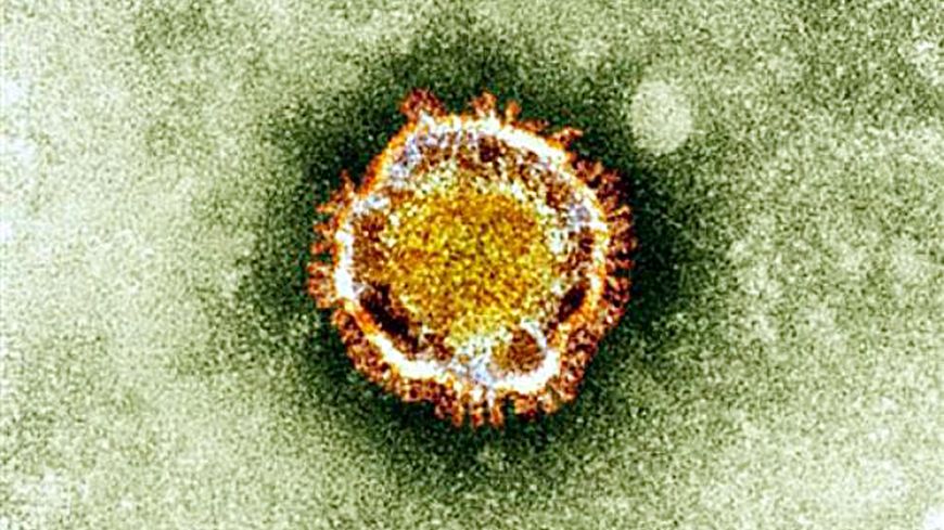 Coronavirus de type SRAS vu sous un microscope électronique.