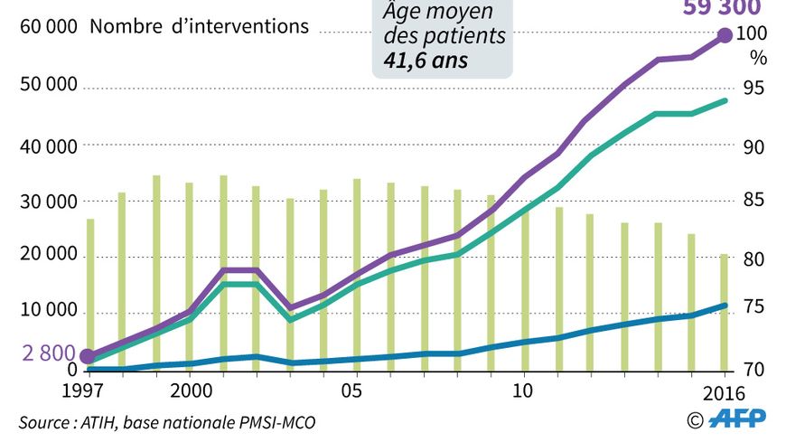 Évolution des interventions de chirurgie de l'obésité entre 1997 et 2016.