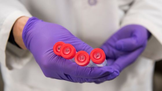 Les cellules Car-T sont-elles un premier pas vers un traitement universel des cancers ? ©AFP - SAUL LOEB / AFP