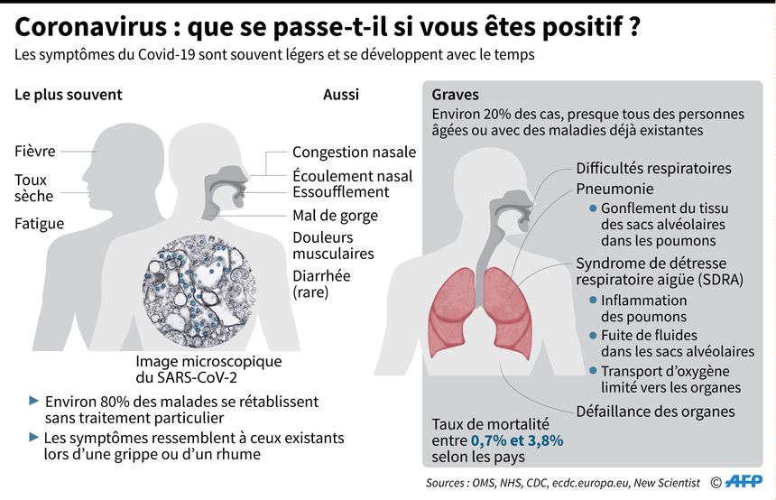 Les principaux symptômes du coronavirus.