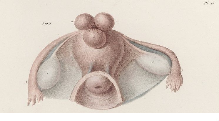 Boivin Marie-Anne, Dugès Antoine, Traité pratique des maladies de l’utérus et des annexes, accompagné d’un atlas de 41 planches in-fol., gravées et coloriées