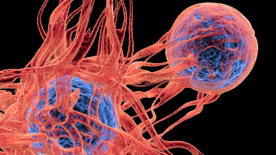En France, 90% des 150.000 décès annuels par cancer sont dus à la présence de tumeurs secondaires. ©Getty - ALFRED PASIEKA/SCIENCE PHOTO LIBRARY