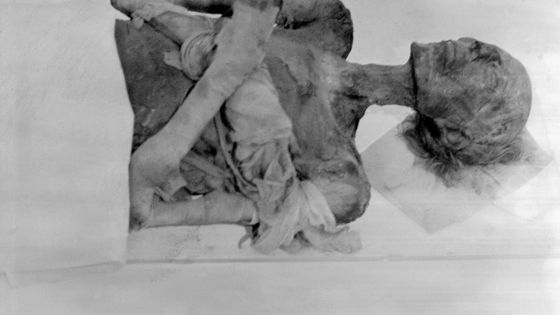 Photo de la momie du pharaon Ramsès II prise en 1976 au musée de l'Homme à Paris où elle était arrivée en septembre afin de subir un traitement d'assainissement. ©AFP