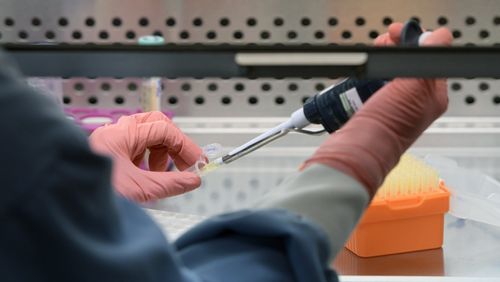 La lutte contre le Covid a-t-elle sapé celle contre le Sida ?