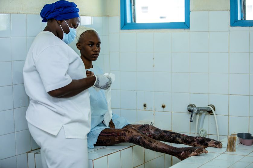 La lèpre : l'autre maladie infectieuse oubliée