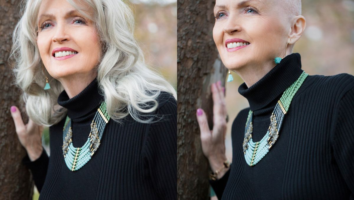 Prothese capillaire nord pas de calais Clearance