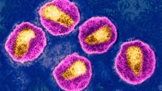 A l’échelle mondiale, près de 37 millions de personnes sont contaminées par le VIH. ©Getty - BSIP