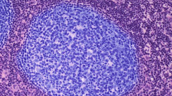 Les ganglions lymphatiques sont le lieu de prolifération et de différenciation des cellules immunitaires. ©Getty - STEVE GSCHMEISSNER/SCIENCE PHOTO LIBRARY