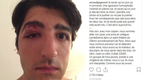 Capture d'écran, sur le compte Instagram d'Arnaud, du récit de son agression le 18 septembre 2018. - Arnaud Gagnoud - Instagram