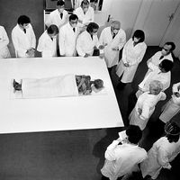 Examen de la momie du Pharaon Ramsès II au Musée de l'Homme, à Paris, le 11 novembre 1976