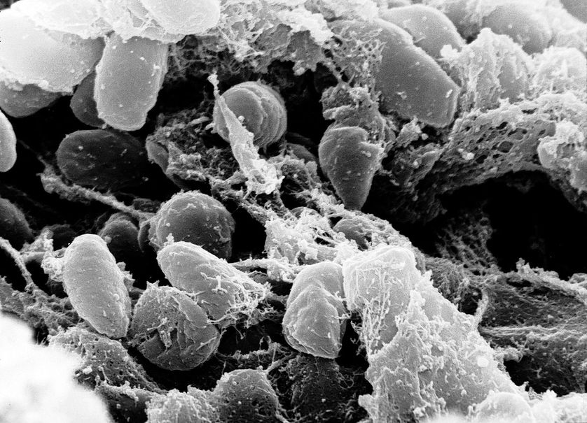 Yersinia pestis, histoires naturelles - Ép. 5/0 - La peste noire