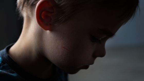 Enfant en souffrance ©Getty - Mrs