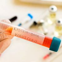 Le virus d’Epstein-Barr est un virus à ADN, de la famille des Herpèsvirus.