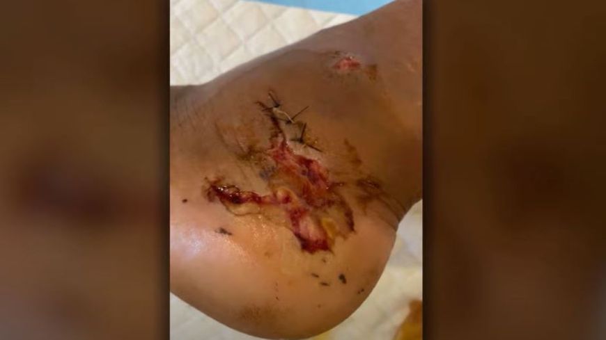 Megan Thee Stallion blessure Tory Lanez - CBS / Aucun(e)