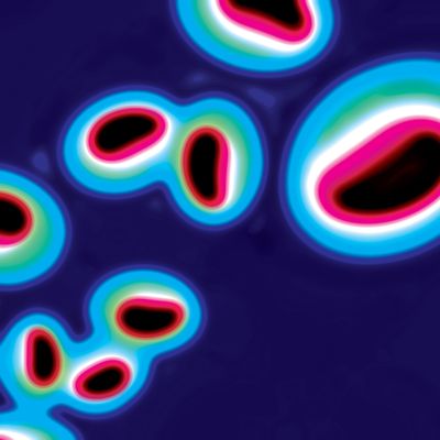 Des Globules