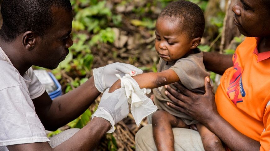 Un enfant malade de la variole du singe recevant un traitement en République centrafricaine