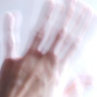 Projet du Pr Laurent Venance : une thérapie innovante dans la maladie de Parkinson